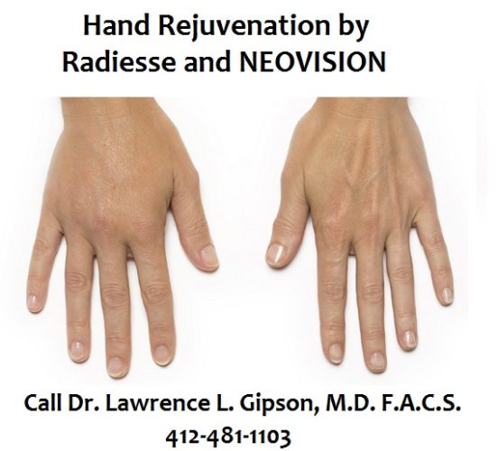 Hand Rejuvenation