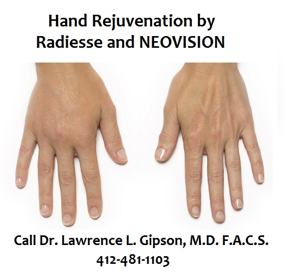 Hand Rejuvenation