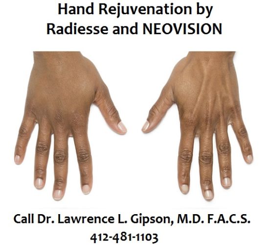 Hand Rejuvenation