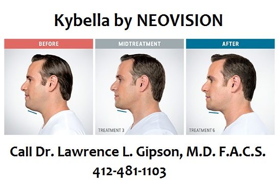 Kybella