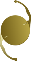 Illustration of a Toric Lens